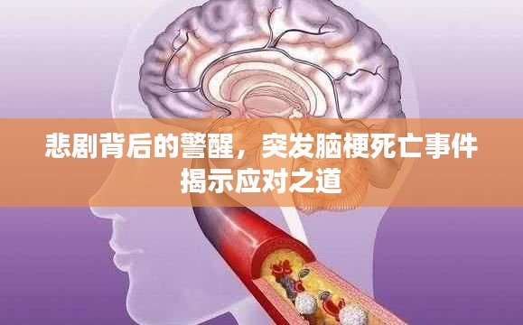 悲剧背后的警醒,突发脑梗死亡事件揭示应对之道